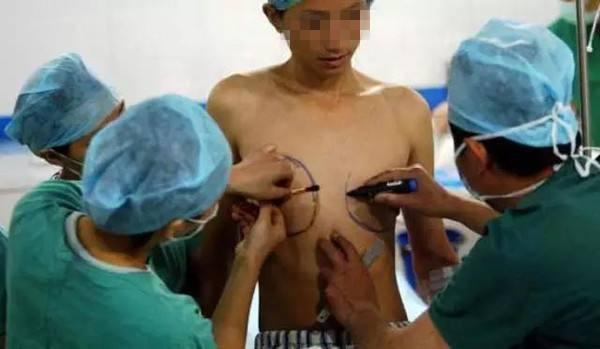 男变女变性人的故事第2张