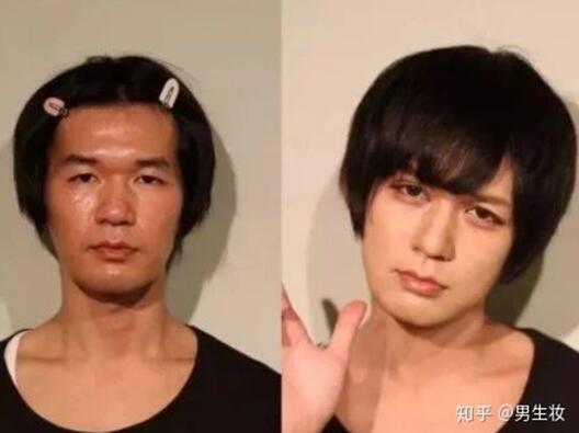 男士需要护肤吗,会不会很娘？第1张