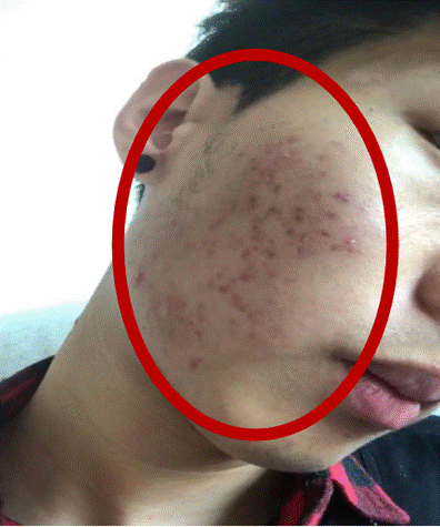 男人的脸部皮肤怎么保养？用什么保养？第3张