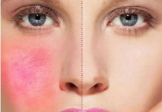 男人的脸部皮肤怎么保养？用什么保养？第11张