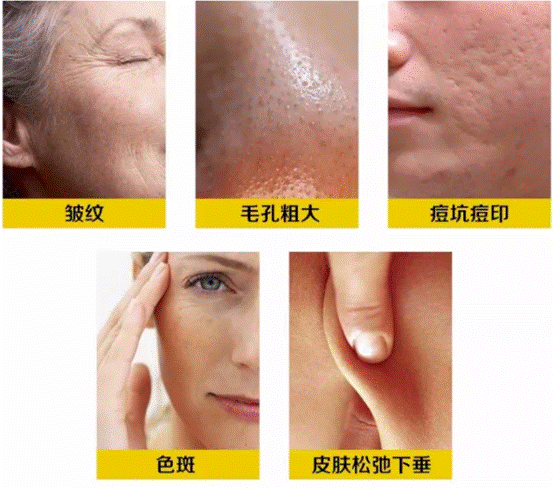 男人的脸部皮肤怎么保养？用什么保养？第15张