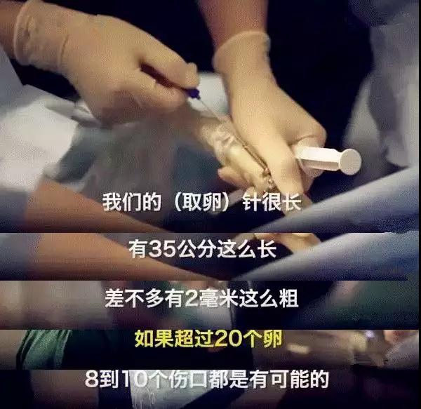 有偿捐卵是什么？别为了钱作践自己第9张