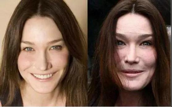 女人为了变美能多不择手段？第7张