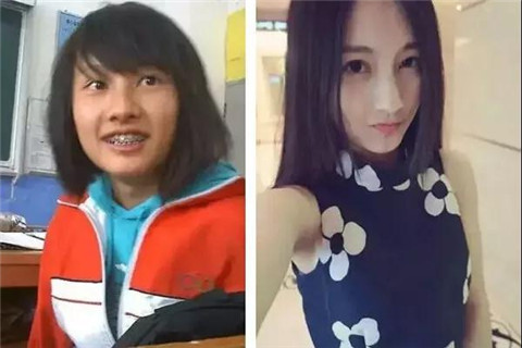 高以翔录节目晕倒后去世，你还在熬夜吗？第21张