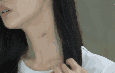 女友膝盖上的淤青，这是被绿了吗？第10张