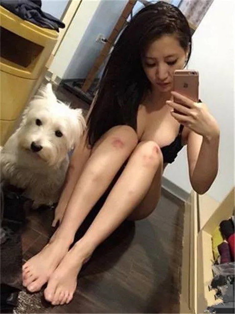 女友膝盖上的淤青，这是被绿了吗？第2张