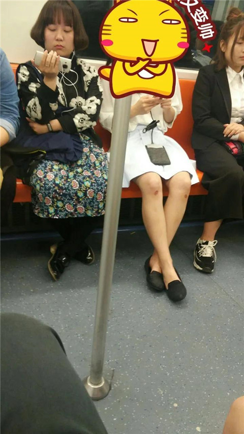 女友膝盖上的淤青，这是被绿了吗？第4张